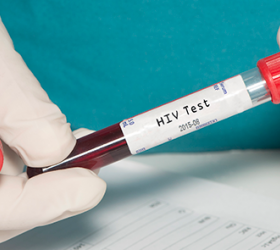 Aumentam os casos de HIV na terceira idade